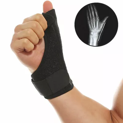 SC Wrist Thumb Hands Splint Support Brace With Removable Steel Splint (1PCS)- UK • £14.90