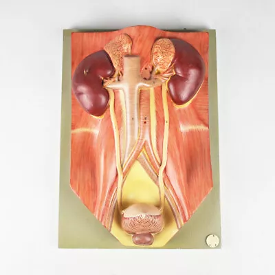 Somso Model - Teaching Kidney - Urinary Tract - Bubble - Anatomy - Vintage • $155.82