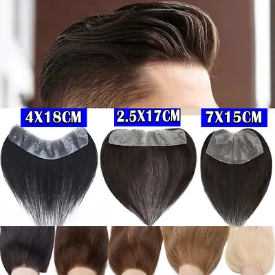 Frontal Human Hair Piece Replacement Mens Hair TOupee TOpper Forehead Hairpiece • $59.89