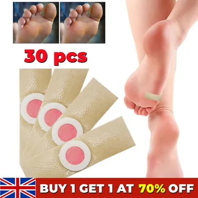 30 Medicated Corn Removal Foot Plasters Natural Wart Remover Carnation Pack Pads • £4.66