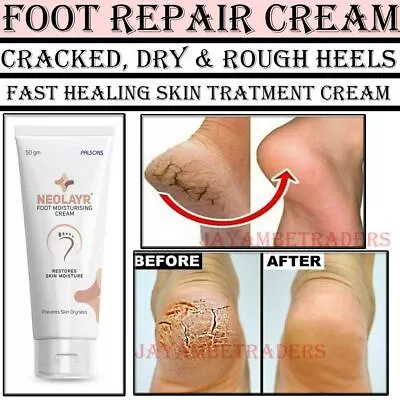 Foot Moisturising Cream Deep Nourishing Repair Dry Rough & Cracked Heels 50gm • $13.94