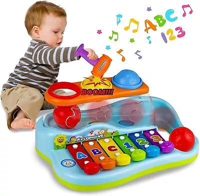 YOLOMOON Baby Toys For 1 2 Year Old Boys Girls Kids Musical Instruments Hammer • $44.75