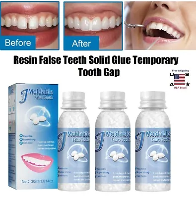 3× Resin False Teeth Solid Glue Temporary Tooth Gap Filler Tooth Repair Moldable • $7.99