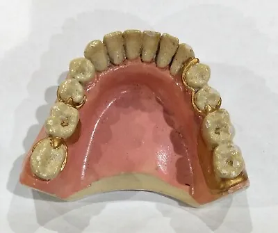 Vintage Dental Partial Denture Sample Oddities Medical Collectible Plaster • $46