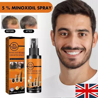 5 % Minoxidil Hair Growth Spray For Men Women Hair Regrowth Treatment 100ml UK • £7.06