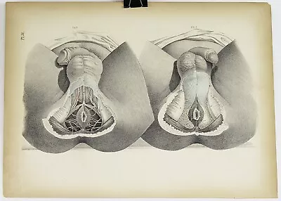 Medical Anatomy Colored Lithograph Print 1850s Vintage Antique 14.25x10.25 #51 • $44.19