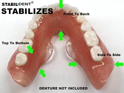 Lower Denture Stabilizers DIY Kit-Affordable Denture Stabilization  • $39.50