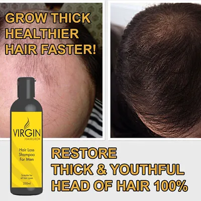 Virgin Hair Growth Shampoo Max Strength Long Thick Glossy Healthy Hair Fast • £19.99