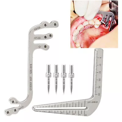 $11.99 • Buy Dental Implant Guide Locator Set Measuring Ruler Calipers/Implant Locating Guide