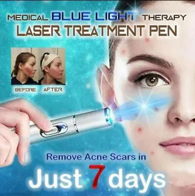 Blue Light Medical Therapy Laser Treatment Pen- Acne Scar Wrinkle Massage Device • £4.72