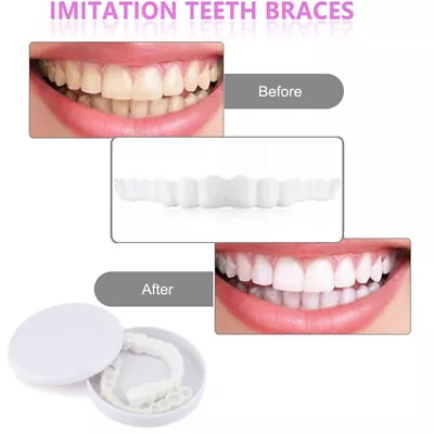$7.39 • Buy Snap On Upper Lower False Teeth Dental Veneers Dentures Fake Tooth Cover Set US