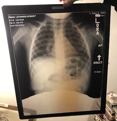 X-ray Film Chest X-ray 3 Year Old Chest X Ray • $9.99