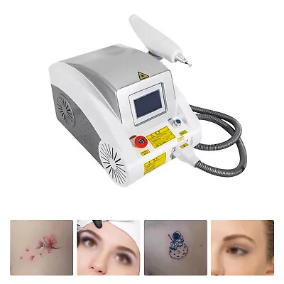 Q Switch ND YAG Laser Machine For Tattoo Removal Skin Whitening + Rejuvenation • $541