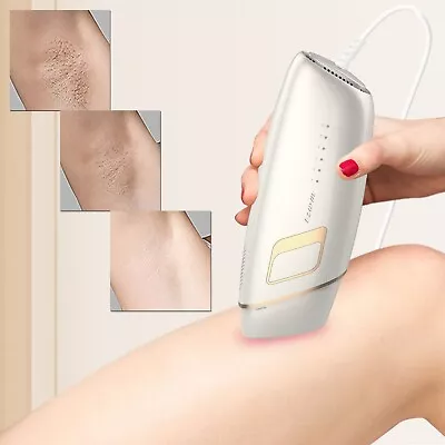 Electric Epilator Full Body Epilators Hair Removal For Men And Women Home Blade • $44.79