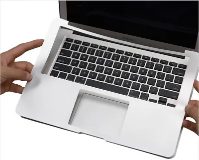 Topcase Skin Sticker Film Cover Protector For MacBook Air 11  A1465 2014 2015 • $13.99