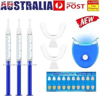 LED System Teeth Whitening Kit Dental Strength White Smile Clean Gel Bleach UV • $14.99