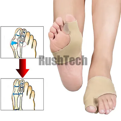 2Pcs Big Toe Bunion Corrector Splint Straightener Foot Pain Relief Hallux Valgus • $6.50