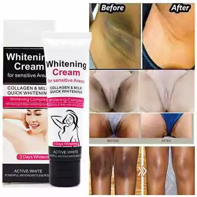 Dark Skin Whitening Cream Armpit Underarm Body Bleaching Lightening Brightening • £6.95