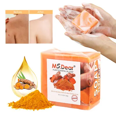 Turmeric Soap Acne Dark Spots Removal Skin Whitening Bleaching Soap Bar Ginger • £15.95