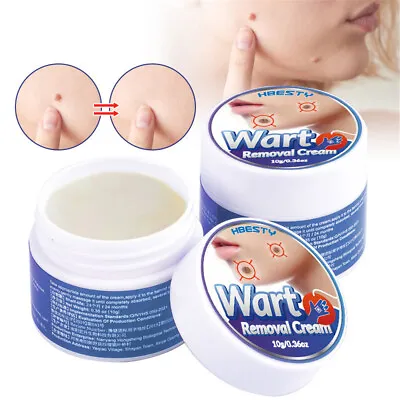 Warts Removal Cream Face Neck Foot Mole Corn Skin Care Tag Remover Treatment UK • £6.59