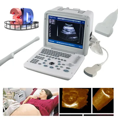 3D Full Digital Ultrasound Scanner Machine +Convex /Linear/Transvaginal Probe • $289