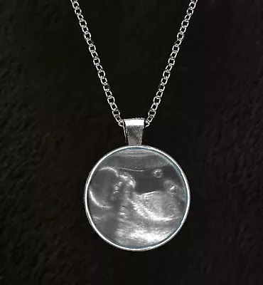 Personalised Baby Scan Photo 18  Silver Plated Necklace Mum Mummy Birthday Gift • £9.50