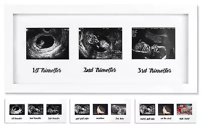 Triple Sonogram Pregnancy Frame - Baby Ultrasound Picture Frame For Expecting... • $29.22