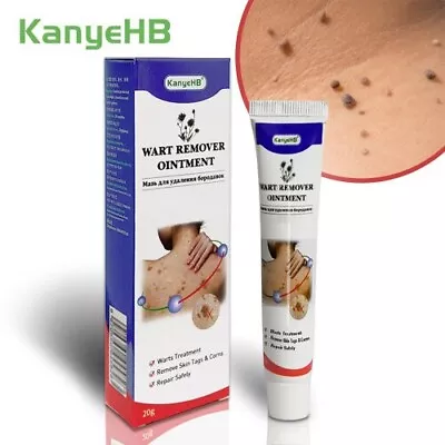 Wart Remover Verrugas Genitales Eliminador Etiquetas Cuello Axila Tratamiento • £10.29