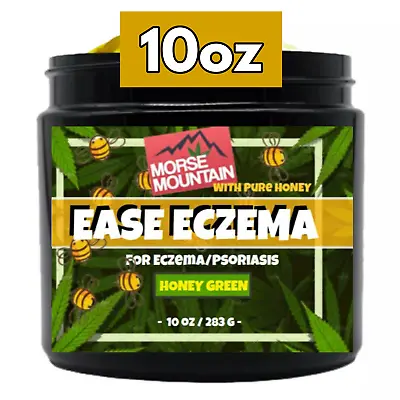 Eczema / Psoriasis Honey Cream Natural Ointment Dermatitis Treatment • $29.87