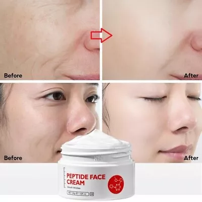 Collagen Pure Face Cream Anti Aging Anti Acne Whitening Cream For Women 30g • $13.67