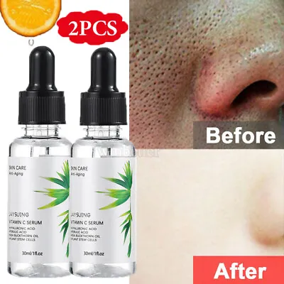 Face Lift Botox Cream Serum ANTI AGEING WRINKLES Skin Tightening & Firming Cream • £8.95