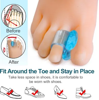 1-Pair Silicone Gel Bunion Corrector & Toe Separator - Orthotic Pain Relief • $6.40