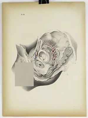 Medical Anatomy Colored Lithograph Print 1850s Vintage Antique 14.25x10.25 #48 • $45.08