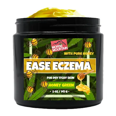 Eczema / Psoriasis Honey Ointment Cream Natural Dermatitis Treatment • $22.39