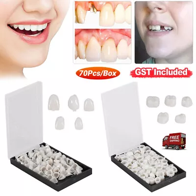 Dental Tooth Temporary Crowns Material Anterior Posterior Teeth Crown Veneers • $8.93