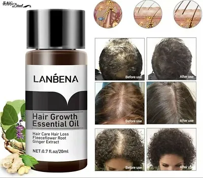 HAIR GROWTH SERUM FOR WOMEN & MEN HAIR GROWTH SCALP TREATMENT - Scalp Serum • £4.99