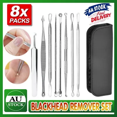$7.43 • Buy 8PCS Blackhead Whitehead Pimple Spot Comedone Extractor Remover Popper Tool Kit