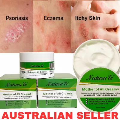 Skin Psoriasis Eczema Anti-Itch Cracked Skin Moisturizing Soothing Cream 100g • $12.84