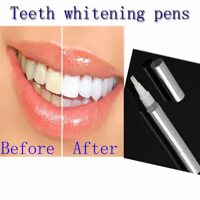$7.42 • Buy White Teeth Whitening Pen Tooth Gel Whitener Bleach Remove Stains Oral Hygiene