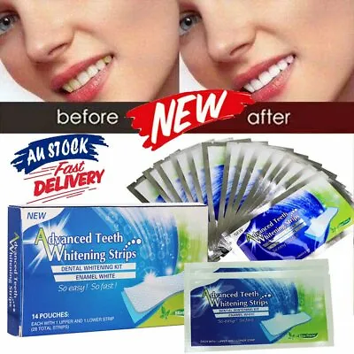 $10.15 • Buy 14 White Strip Professional Bleaching Teeth Whitening Strips Tooth Advanced OD