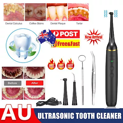 Tartar Scaler Electric Ultrasonic Dental Calculus Remover Tooth Plaque Cleaner • $22.26