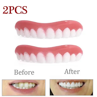 2PCS Cosmetic Teeth Upper Small Smile Tooth Secure Veneers False Dental Natural • $10.26