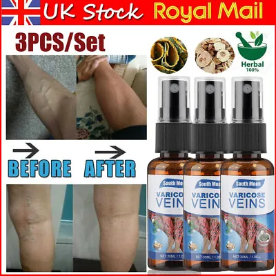 £10.95 • Buy 3x Varicose Veins Spray Miracle Cream Relief Pain Vasculitis Phlebitis Spray UK