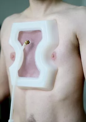 $439 • Buy Vacuum Bell - Pectus Excavatum - Mens