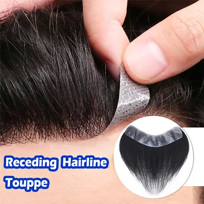 Invisible Skin Tape In Human Hair Toupee Men Frontal Hairline Forehead Hairpiece • £50.50