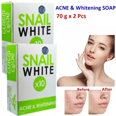 SOAP Gluta Snail White Anti ACNE Whitening Skin Dark Spots Body Cleansing 2 Bars • $10.83