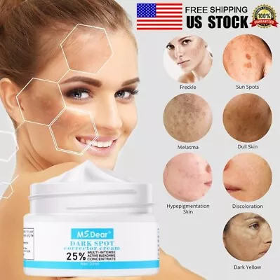 Strong Removal Melasma Whitening Cream Sunburn Speckle Freckle Spots Pigment US • $8.95