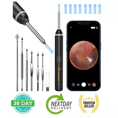 Ear Wax Removal Kit - Ear Camera - Ear Cleaner Otoscope - Iphone Ipad Android • £24.73