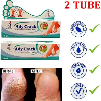 Foot Repair Cream For Dry Cracked Heels - Salicylic Acid Shea Butter Vitamin E • $15.03