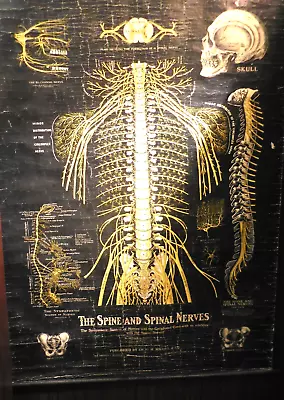 Original 1914 Medical Wall Chart “The Spine And Spinal Nerves  Dr. G. Michel • $175